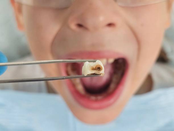 Emergency Dentist for Kids in NY